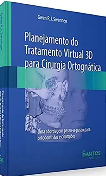 Imagem de Planejamento do Tratamento Virtual 3D para Cirurgia Ortognática