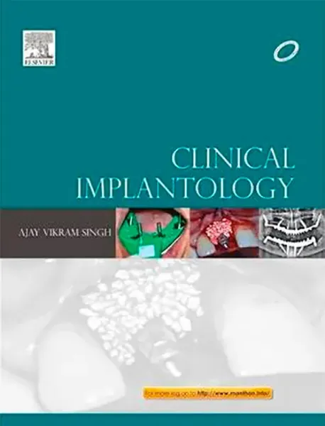 Imagem de Clinical Implantology