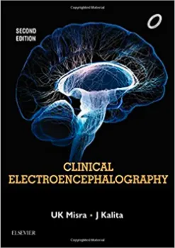 Imagem de Clinical Electroencephalography