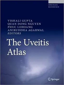 Picture of Book The Uveitis Atlas