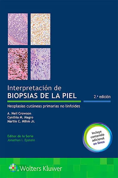 Imagem de Interpretación de Biopsias de la Piel: Neoplasias Cutáneas Primarias no Linfoides