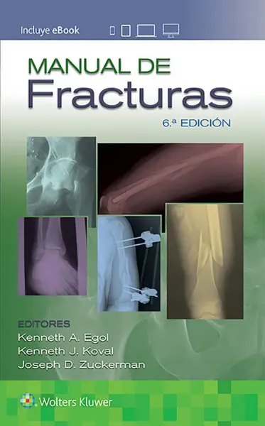 Imagem de Manual de Fracturas (Espanhol)