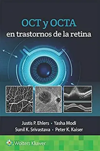 Imagem de OCT y OCTA en Trastornos de la Retina