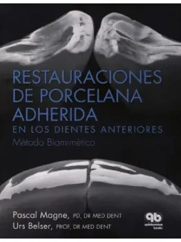 Picture of Book Restauraciones de Porcelana Adherida en los Dientes Anteriores: Un Enfoque Biomimético