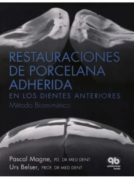 Imagem de Restauraciones de Porcelana Adherida en los Dientes Anteriores: Un Enfoque Biomimético