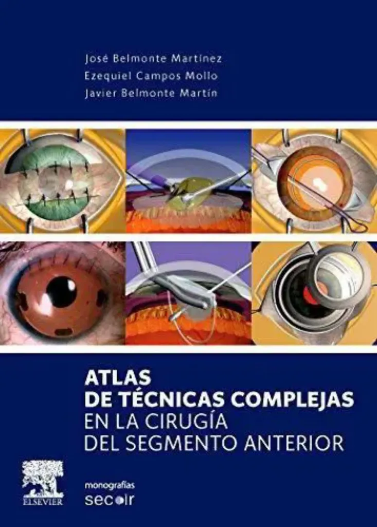 Imagem de Atlas de Técnicas Complejas en la Cirugía del Segmento Anterior