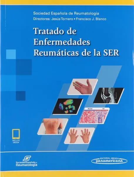 Imagem de Tratado de Enfermedades Reumáticas de la SER