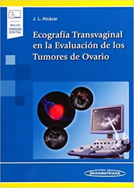 Imagem de Ecografía Transvaginal en la Evaluación de los Tumores de Ovario