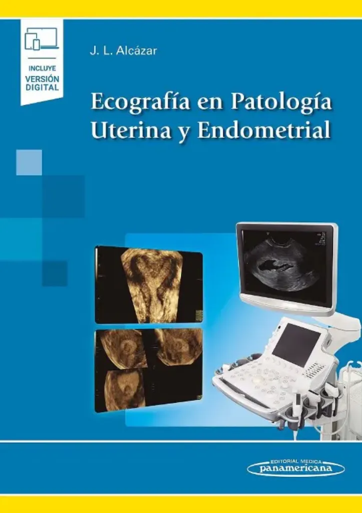 Picture of Book Ecografía en Patología Uterina y Endometrial (incluye versión digital)