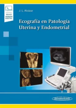 Imagem de Ecografía en Patología Uterina y Endometrial (incluye versión digital)