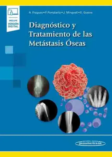 Imagem de Diagnóstico y Tratamiento de las Metástasis Óseas