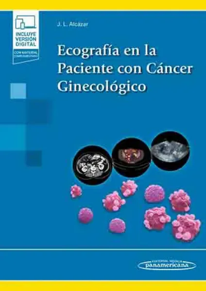 Imagem de Ecografía en la Paciente con Cáncer Ginecológico
