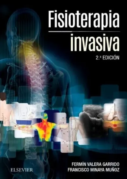 Imagem de Fisioterapia Invasiva