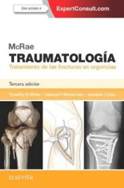 Imagem de McRae Traumatología - Tratamiento de las Fracturas en Urgencias + ExpertConsult