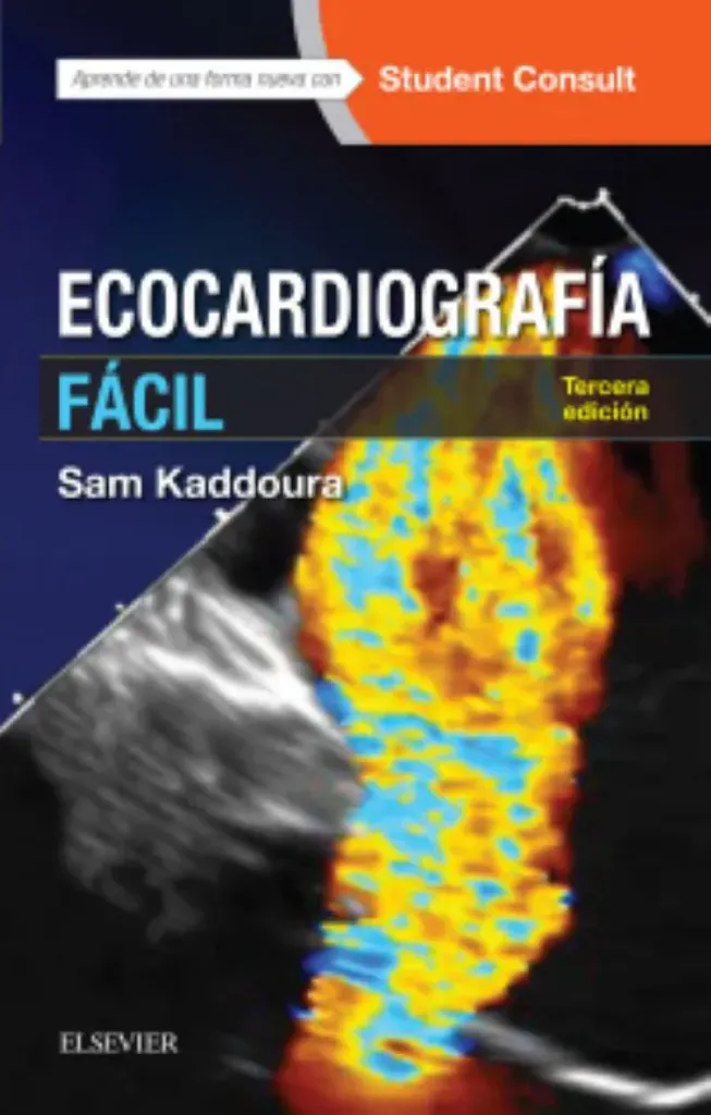 Imagem de Ecocardiografía Fácil