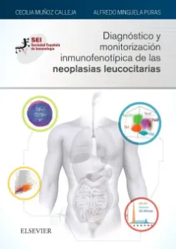 Picture of Book Diagnóstico y Monitorización Inmunofenotípica de las Neoplasias Leucocitarias: Sociedad Española de Inmunología