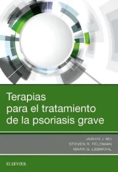 Imagem de Terapias para el Tratamiento de la Psoriasis Grave