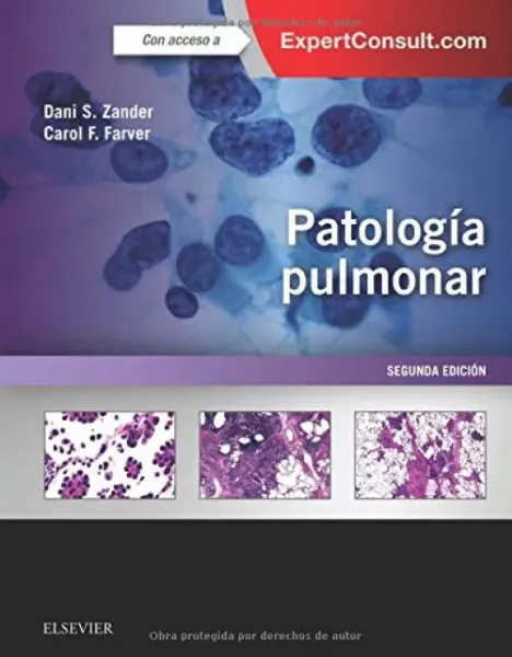 Picture of Book Patología Pulmonar