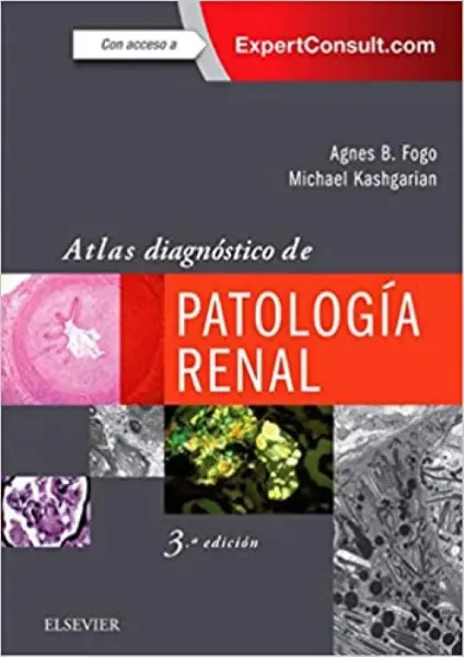 Imagem de Atlas Diagnóstico de Patología Renal