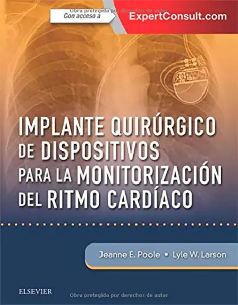 Imagem de Implante Quirúrgico de Dispositivos para la Monitorización del Ritmo Cardíaco