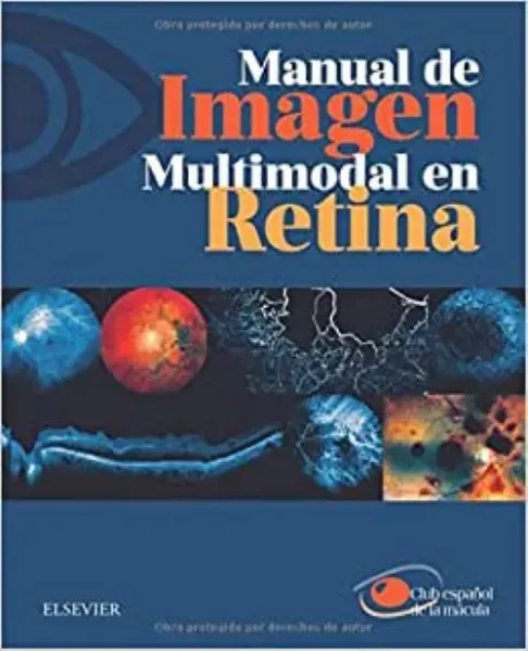 Imagem de Manual de Imagen Multimodal en Retina