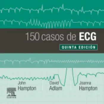 Picture of Book 150 Casos de ECG (Espanhol)