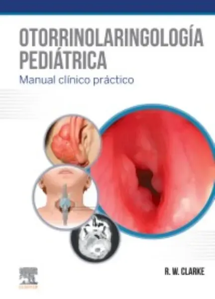 Imagem de Otorrinolaringología Pediátrica (edição Espanhola)