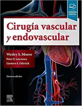 Imagem de Cirugía Vascular y Endovascular: Una Revisión Exhaustiva