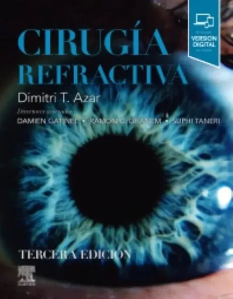 Imagem de Cirugía Refractiva