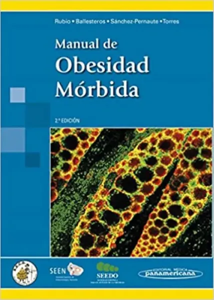 Imagem de Manual de Obesidad Mórbida