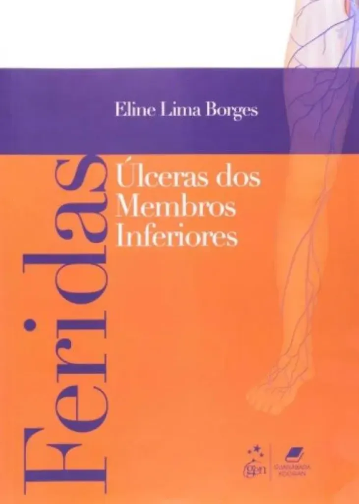 Imagem de Feridas Úlceras de Membros Inferiores