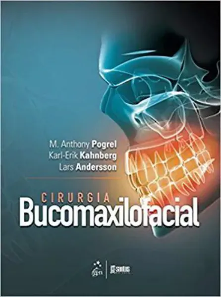 Imagem de Cirurgia Bucomaxilofacial