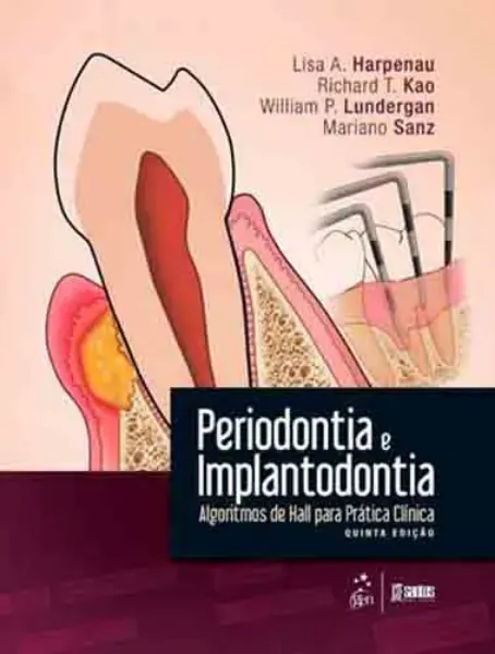Imagem de Periodontia e Implantodontia - Algoritmos Hall Prática Clínica
