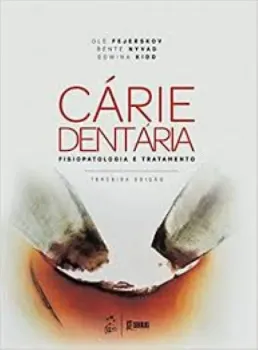 Picture of Book Cárie Dentária: Fisiopatologia e Tratamento