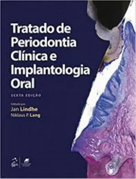 Imagem de Tratado de Periodontia Clínica e Implantologia Oral