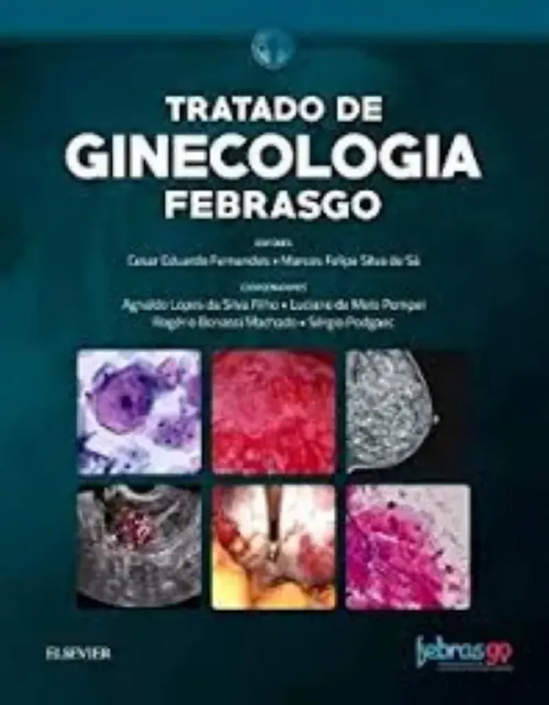 Imagem de Tratado de Ginecologia Febrasgo