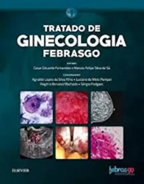 Imagem de Tratado de Ginecologia Febrasgo