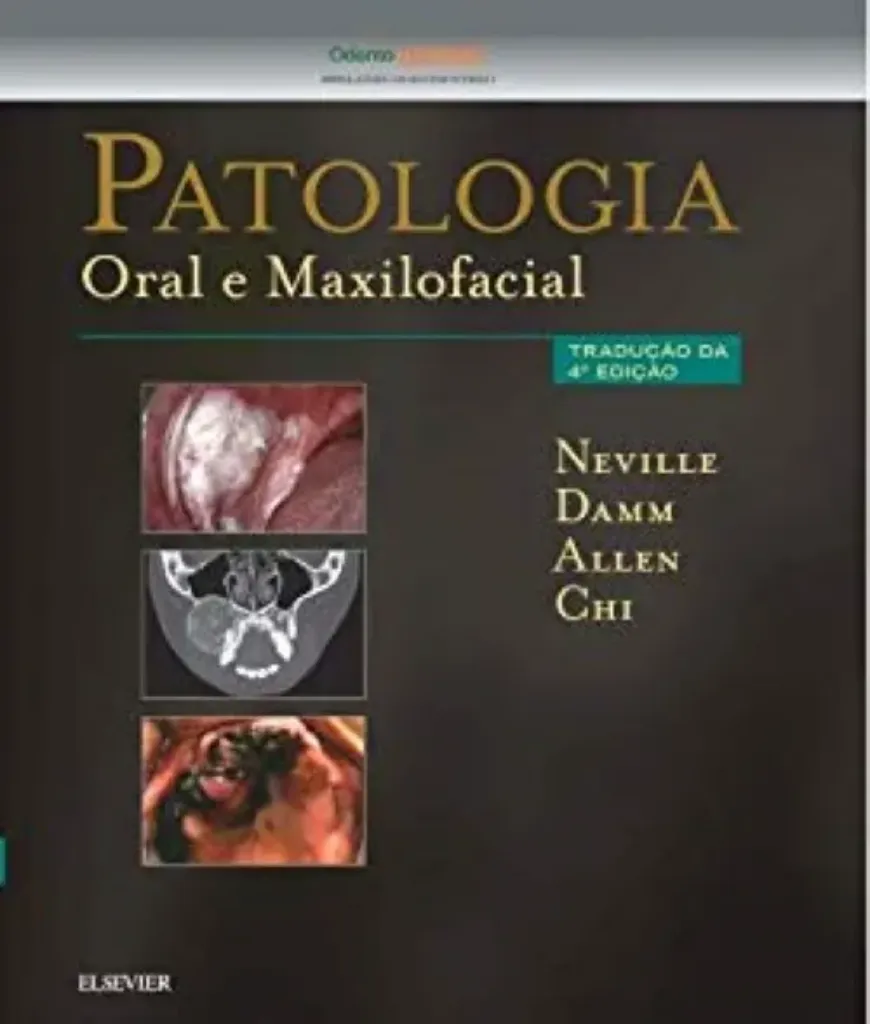 Imagem de Patologia Oral e Maxilofacial