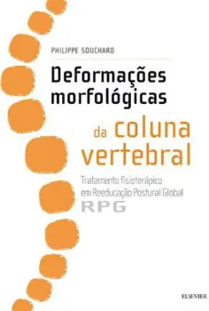 Imagem de Deformações Morfológicas da Coluna Vertebral - Tratamento Fisioterápico em Reeducação Postural Global RPG