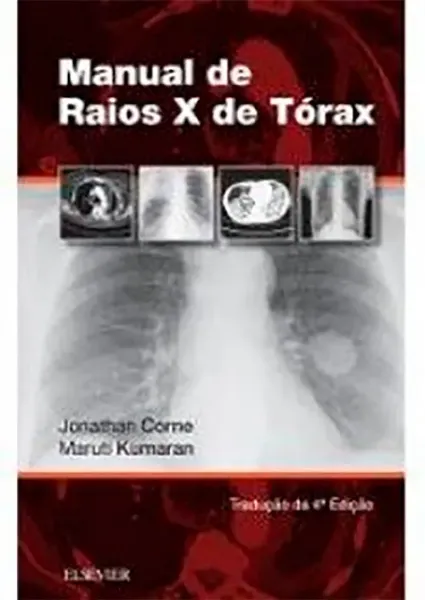 Imagem de Manual de Raios X do Torax