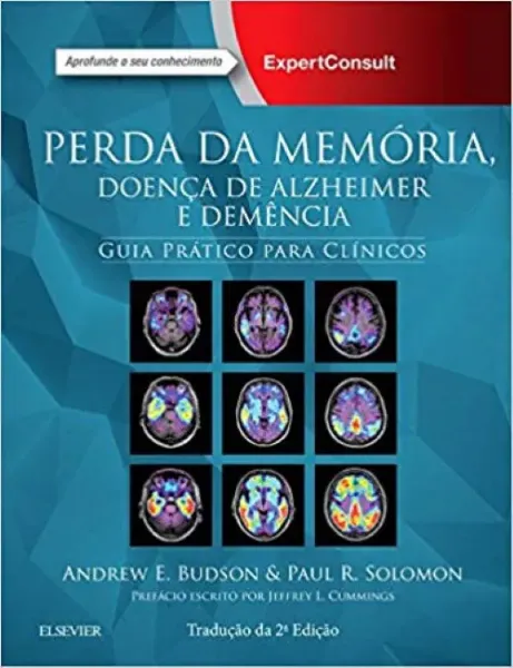 Imagem de Perda da Memória, Doença de Alzheimer e Demência