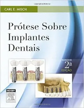 Picture of Book Prótese Sobre Implantes Dentais