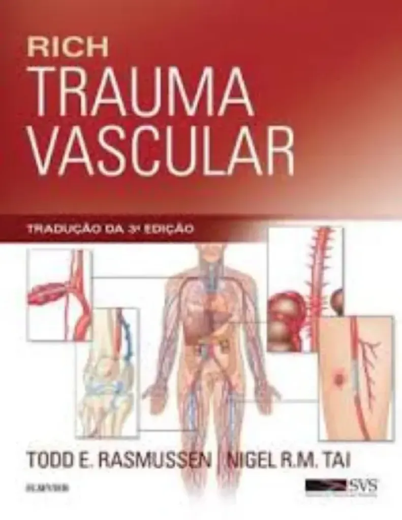 Imagem de Rich Trauma Vascular