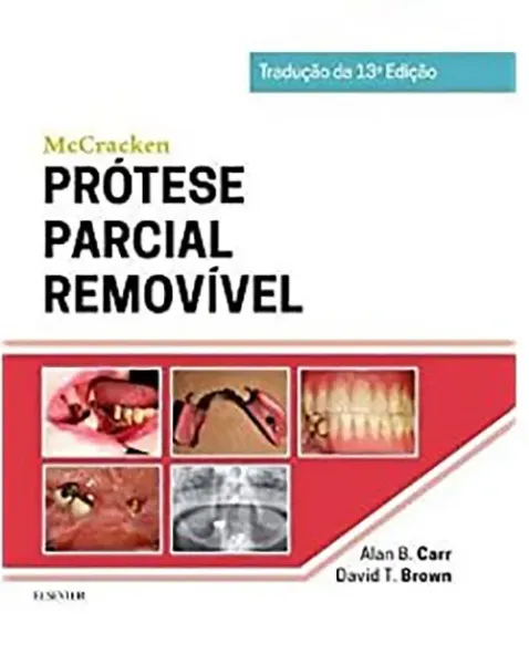 Imagem de Mccracken Prótese Parcial Removível