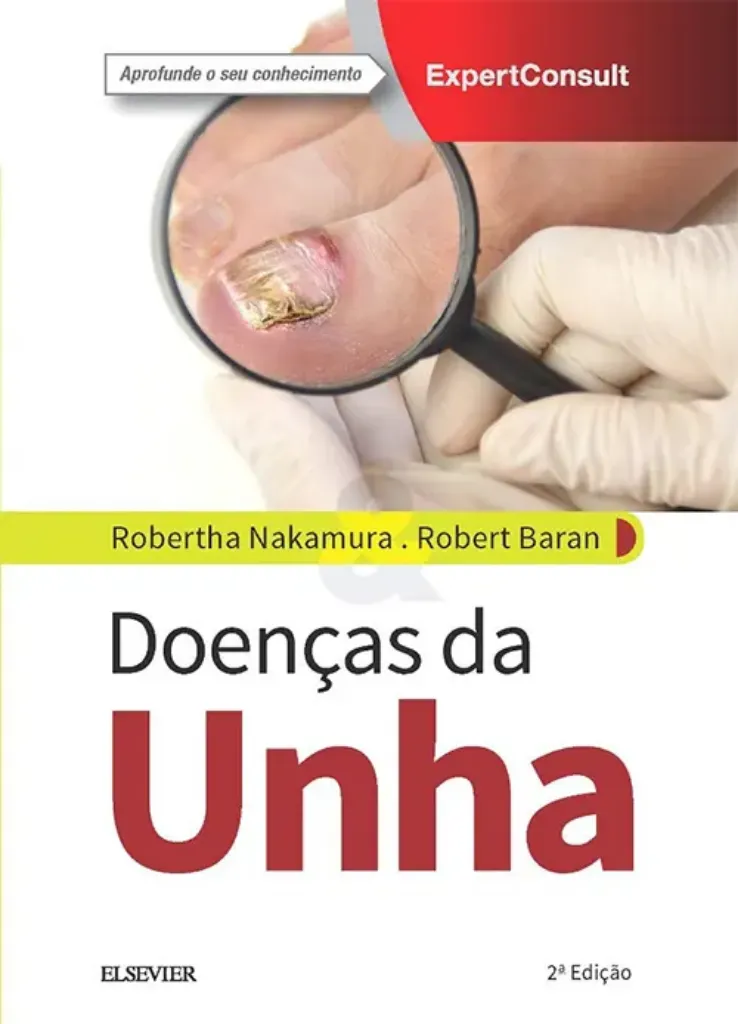 Imagem de Doenças da Unha