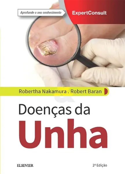 Imagem de Doenças da Unha