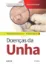 Imagem de Doenças da Unha