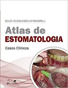 Imagem de Atlas de Estomatologia - Casos Clínicos