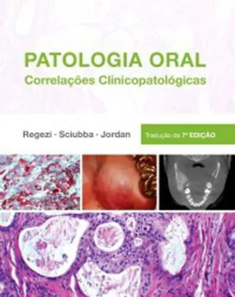 Imagem de Patologia Oral Correlações Clinicopatológicas