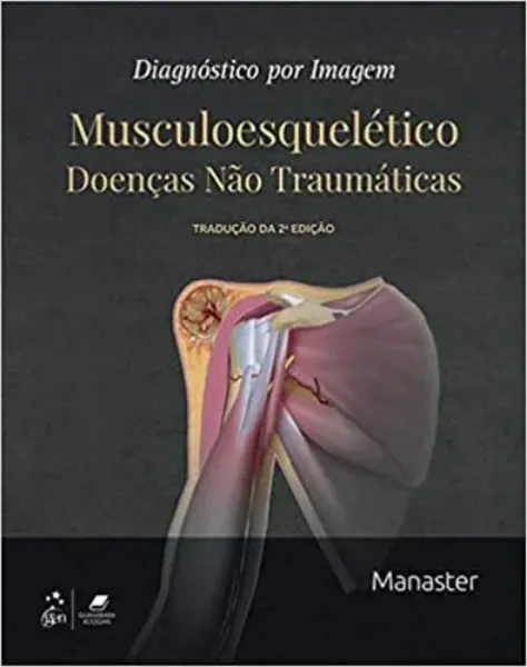 Imagem de Diagnóstico por Imagem MusculoesquelétIco Doença Não Trauma